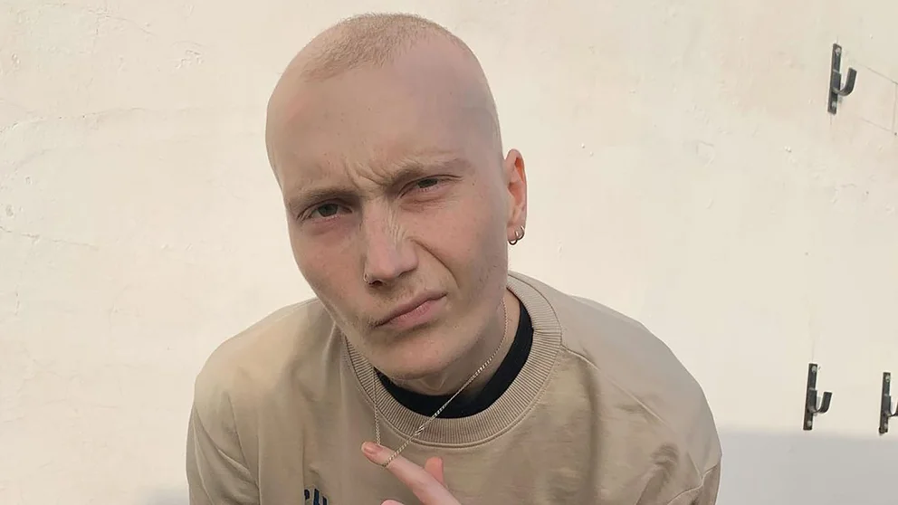 Murió Charlie, el famoso tiktoker español que contaba cómo era vivir con cáncer: el video de la despedida