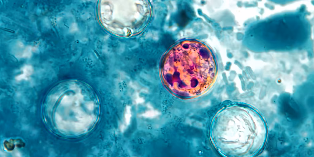 Un brote histórico de ciclosporiasis afecta ya a más de 30 estados de Estados Unidos