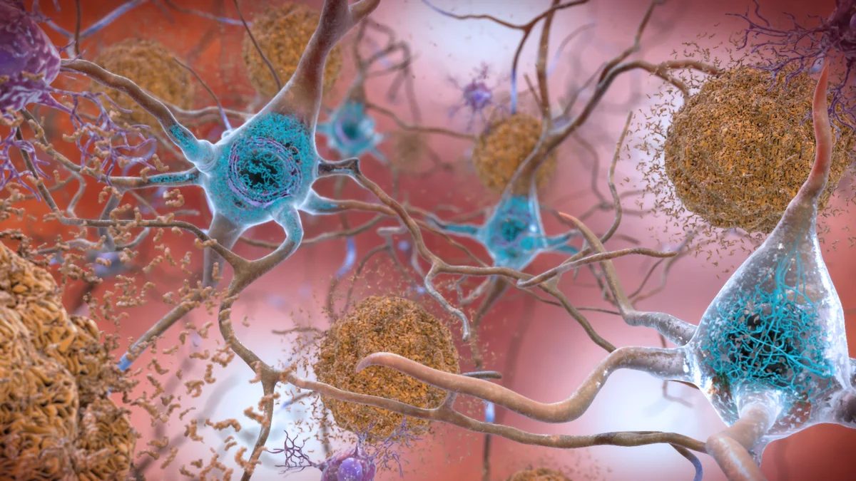 Científicos descubren que la proteína SORLA podría revertir el daño cerebral vinculado al Alzheimer