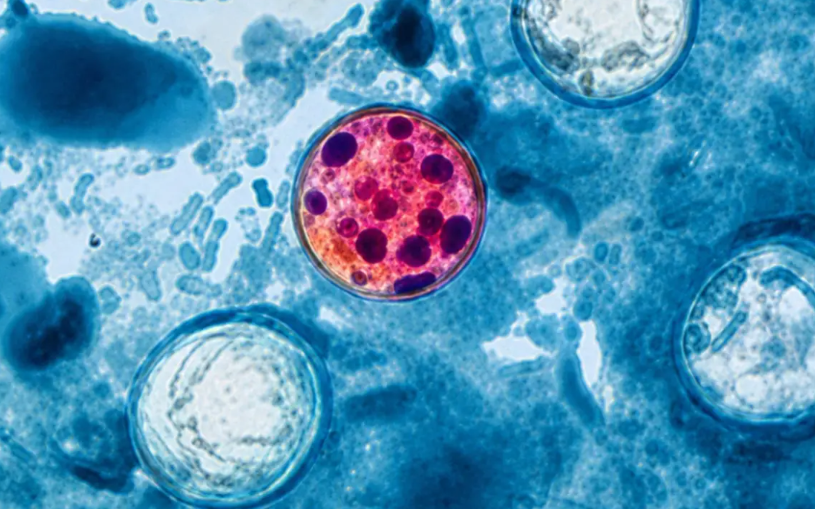 Investigaciones no determinaron que productos mexicanos originaran brotes de Salmonella y Cyclospora: Cofepris